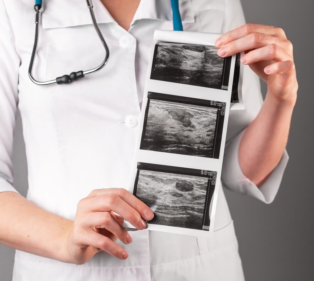 Lekarka trzyma w ręce wyniki usg piersi.